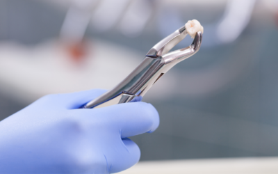 Surgical Tooth Extraction vs. Simple Extraction: What Is the Difference?