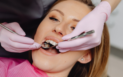 What Is the All-on-4 Dental Implant Procedure and Is It Right for You?
