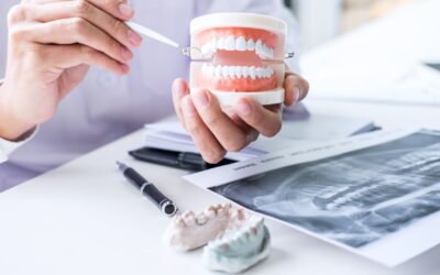 What Is Ridge Augmentation and When Is It Needed Before Implants?