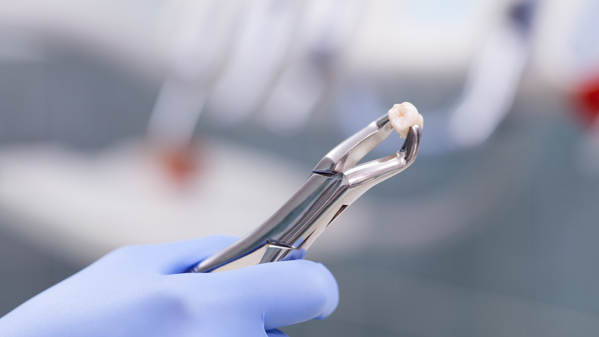 Emergency Tooth Extraction in Star, Meridian, Eagle, Nampa, & Caldwell