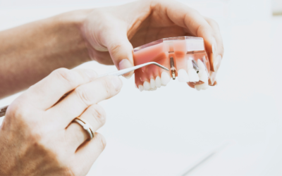 What to Expect at Your First Dental Implant Consultation